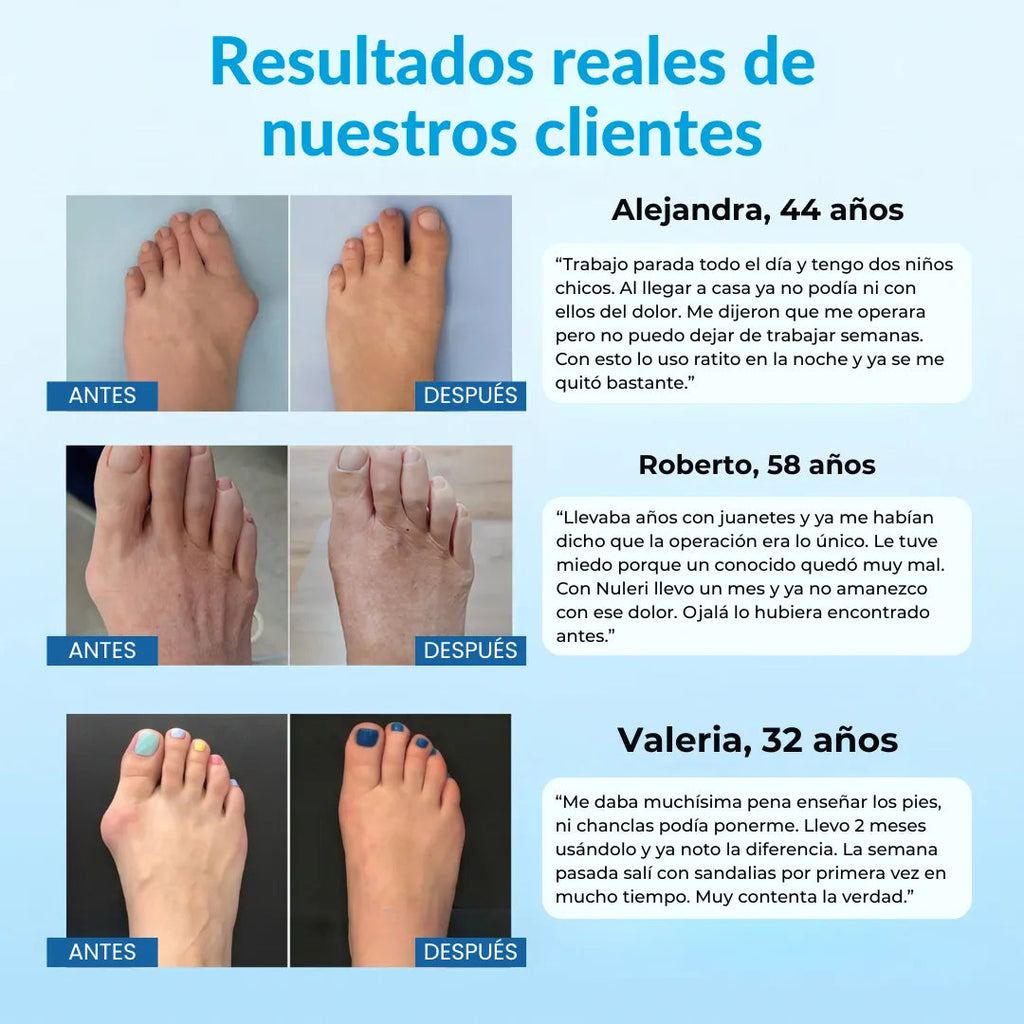 CORRECTOR PROFESIONAL DE JUANETES