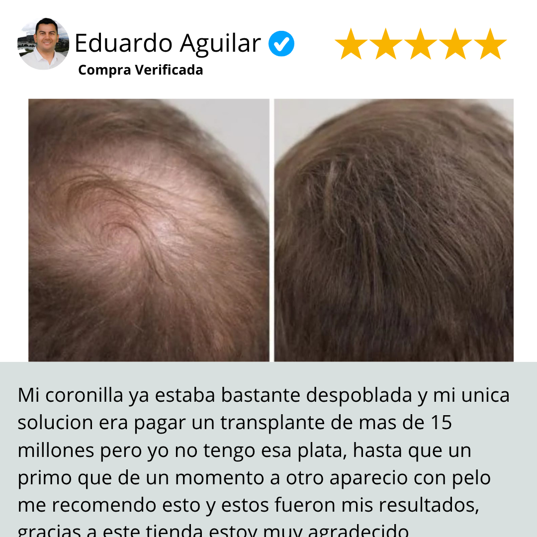 TIVENO™ - Pigmento capilar Italiano