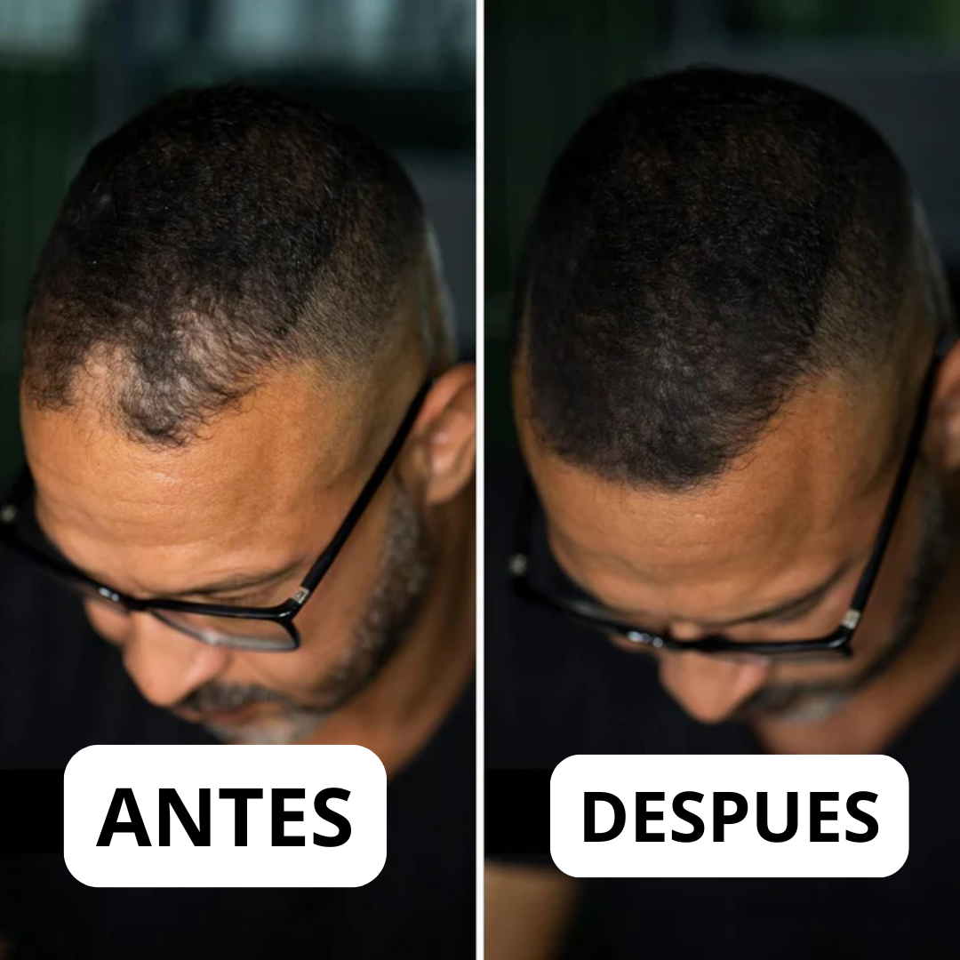 Antes